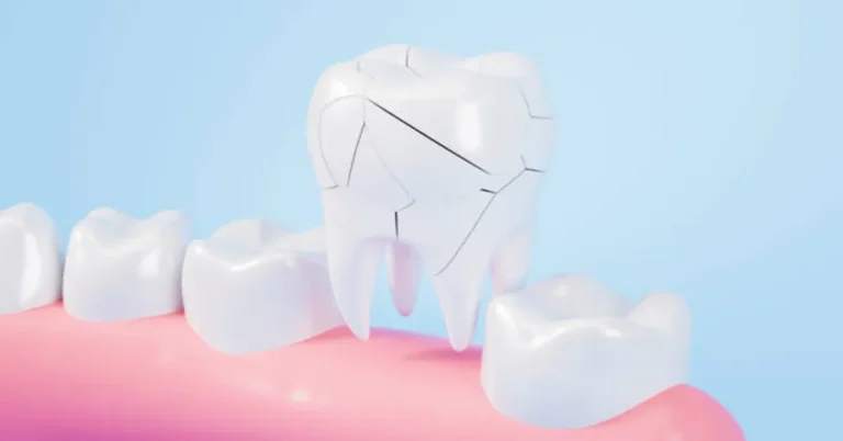 Chipped Tooth Crown