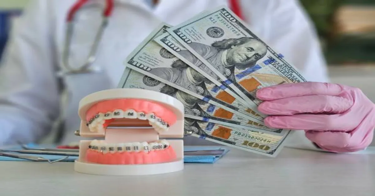 How Much Are Braces